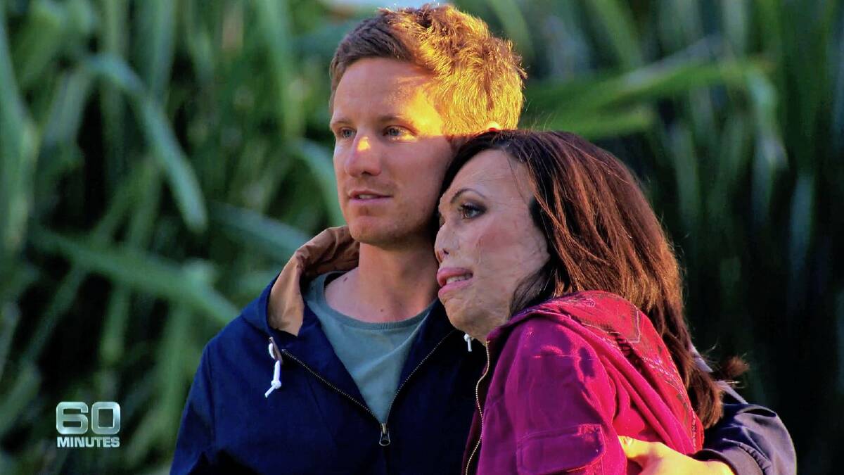 LOOKING FORWARD: Turia Pitt has taken the next big step in her recovery, removing the mask worn to aid her recovery and, with partner Michael Hoskins supporting her, is excited about her book launch. Photos courtesy 60 MINUTES.
