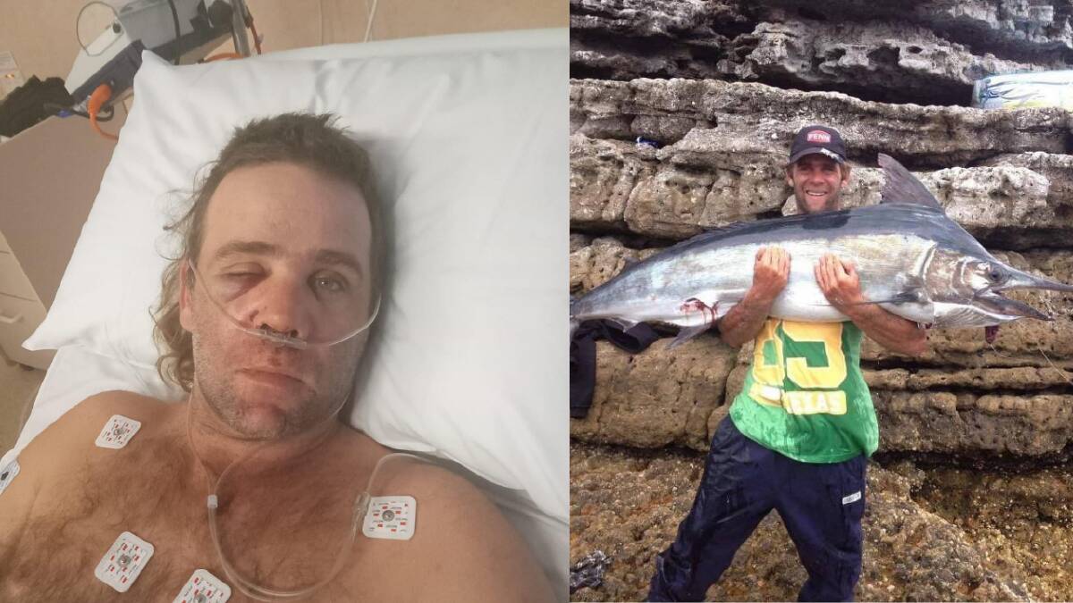FUNDRAISER: Phillip Baldock is recovering at Wollongong Hospital after a crash over the weekend. Pictures: supplied.